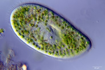 A Paramecium Bursaria filled with algae.