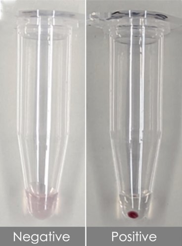 Two vessels side by side. The negative vessel has a clear liquid and the positive one is tinted red. 